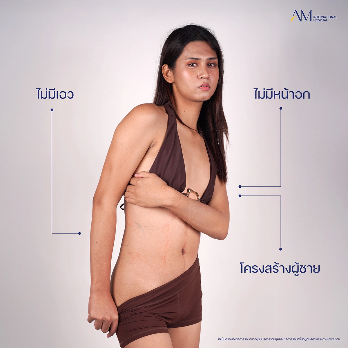 คุณลูกพลับ Surgery Wars ที่ AM
