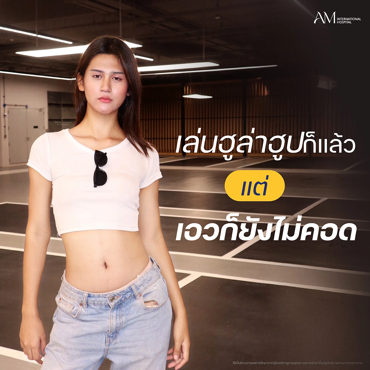 เล่นฮูล่าฮูบแต่เอวก็ยังไม่คอด