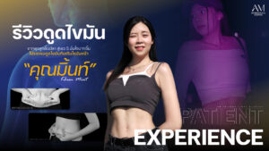 รีวิวดูดไขมัน