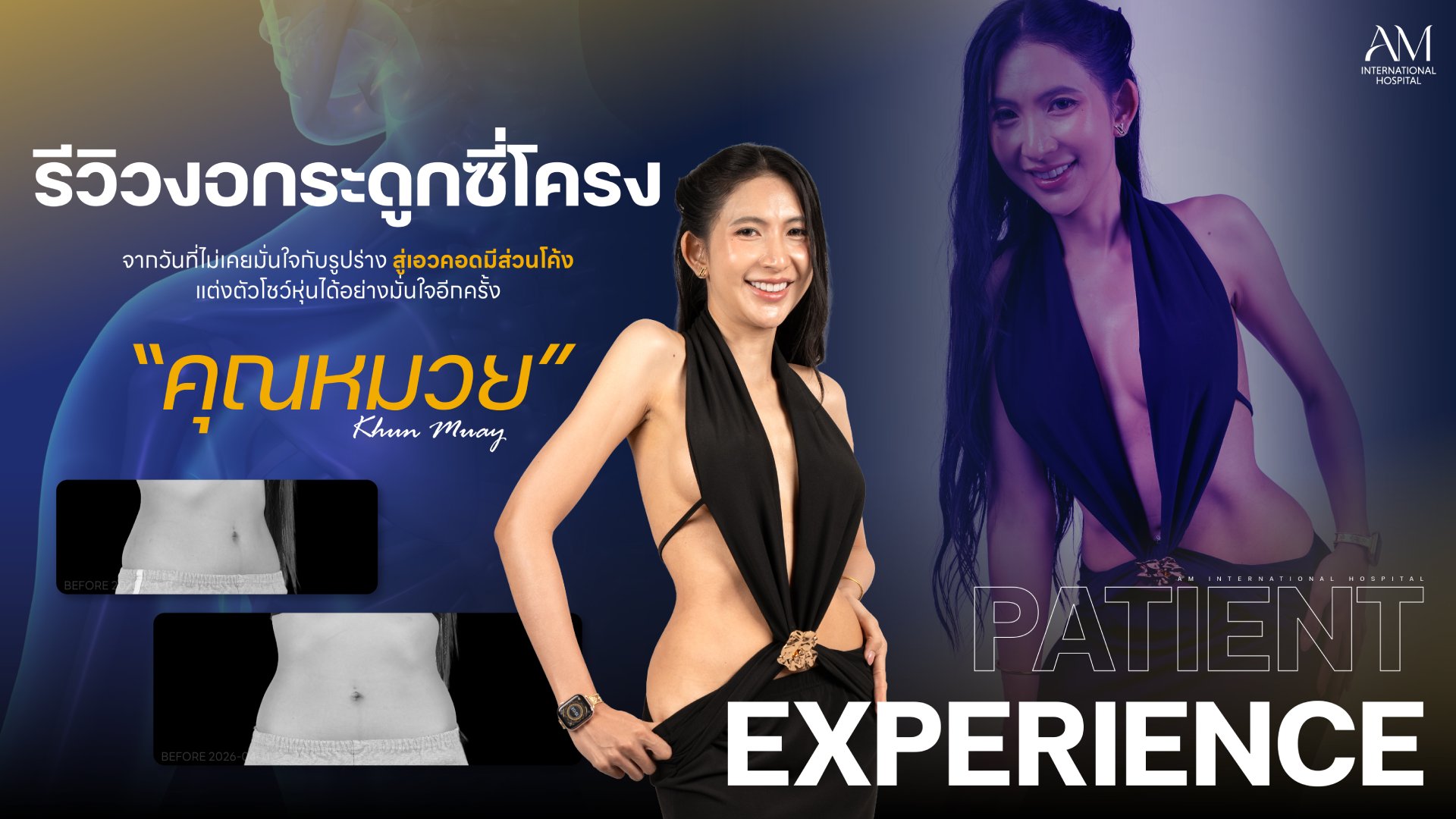 รีวิว Corset Waist