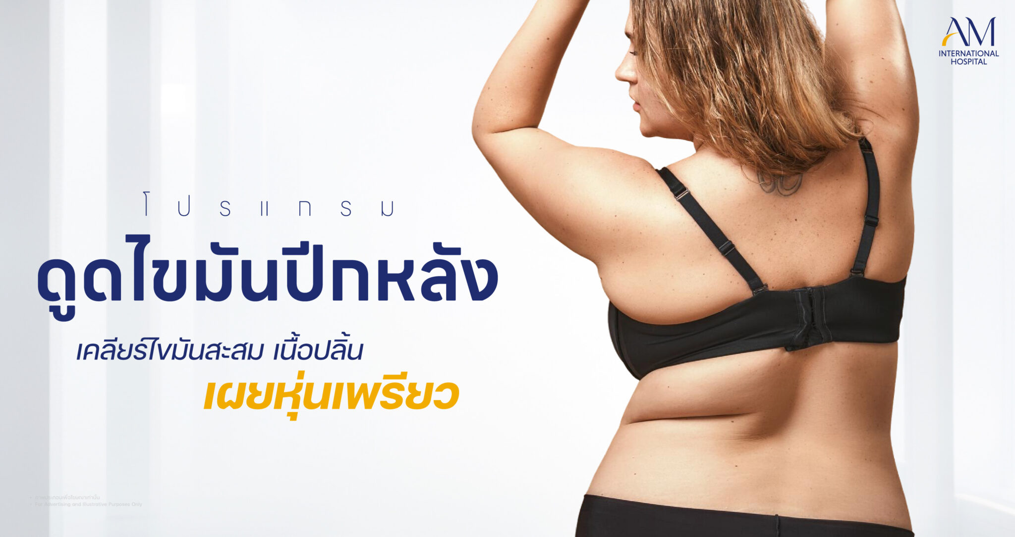 ดูดไขมันปีกหลัง
