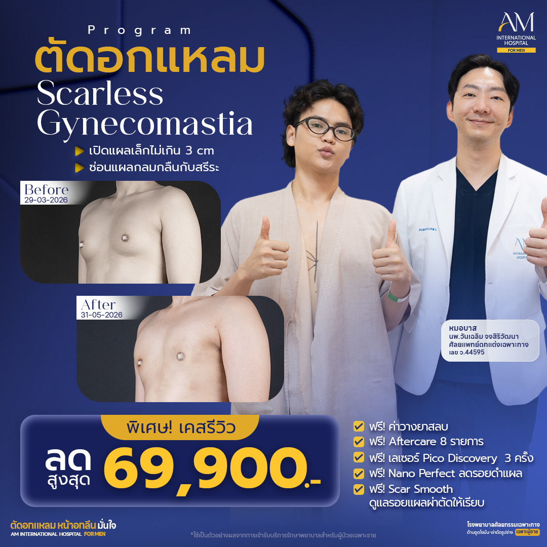 20260724-Conver-Promotion-Single-โปรตัดอก ส.ค. 69_0