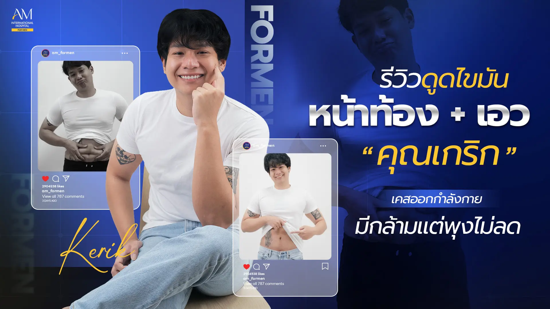 รีวิวดูดไขมันซิกแพค