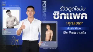รีวิวดูดไขมันซิกแพค