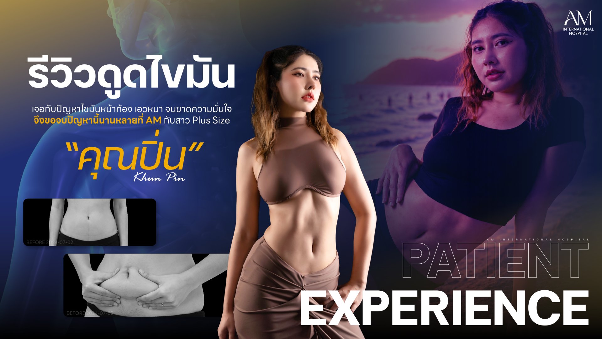 รีวิวดูดไขมัน