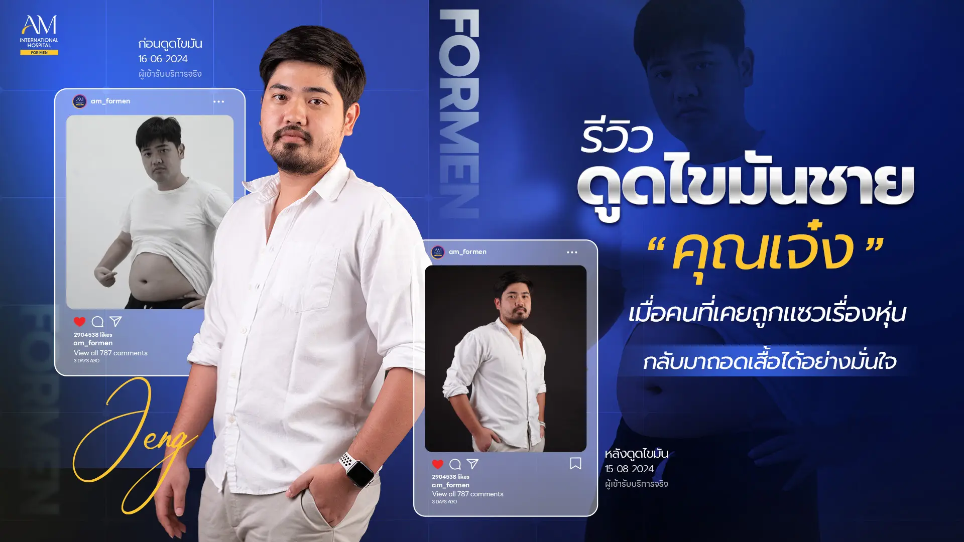 รีวิวดูดไขมัน