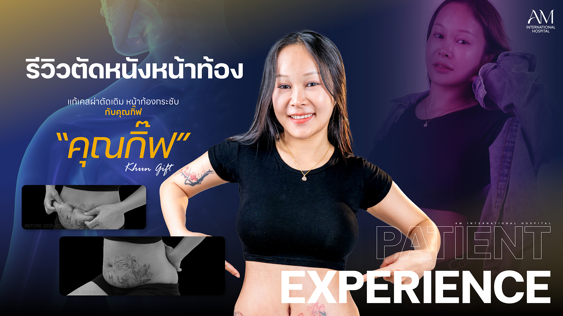 รีวิวตัดหนังหน้าท้อง