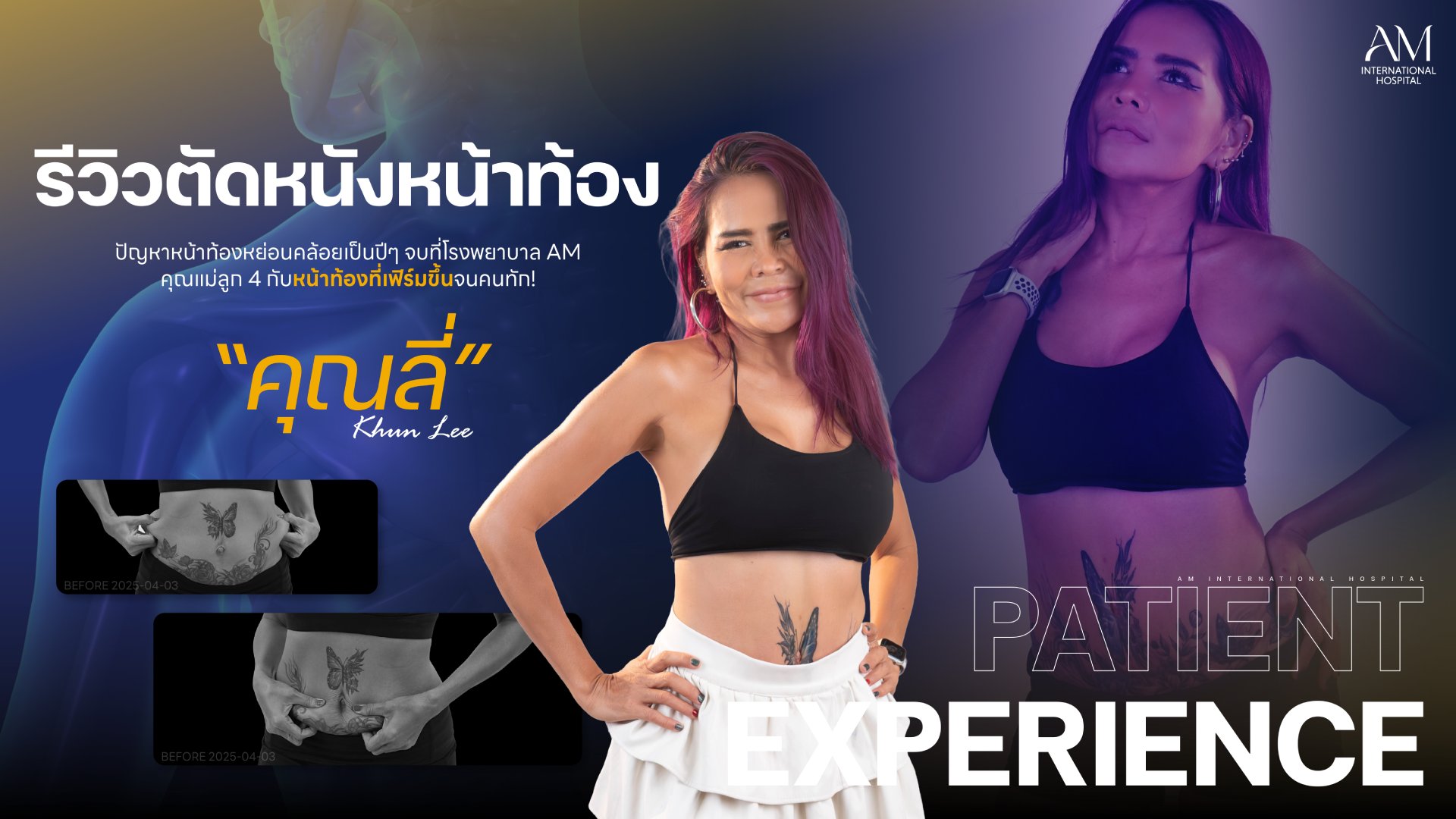 รีวิวตัดหนังหน้าท้อง