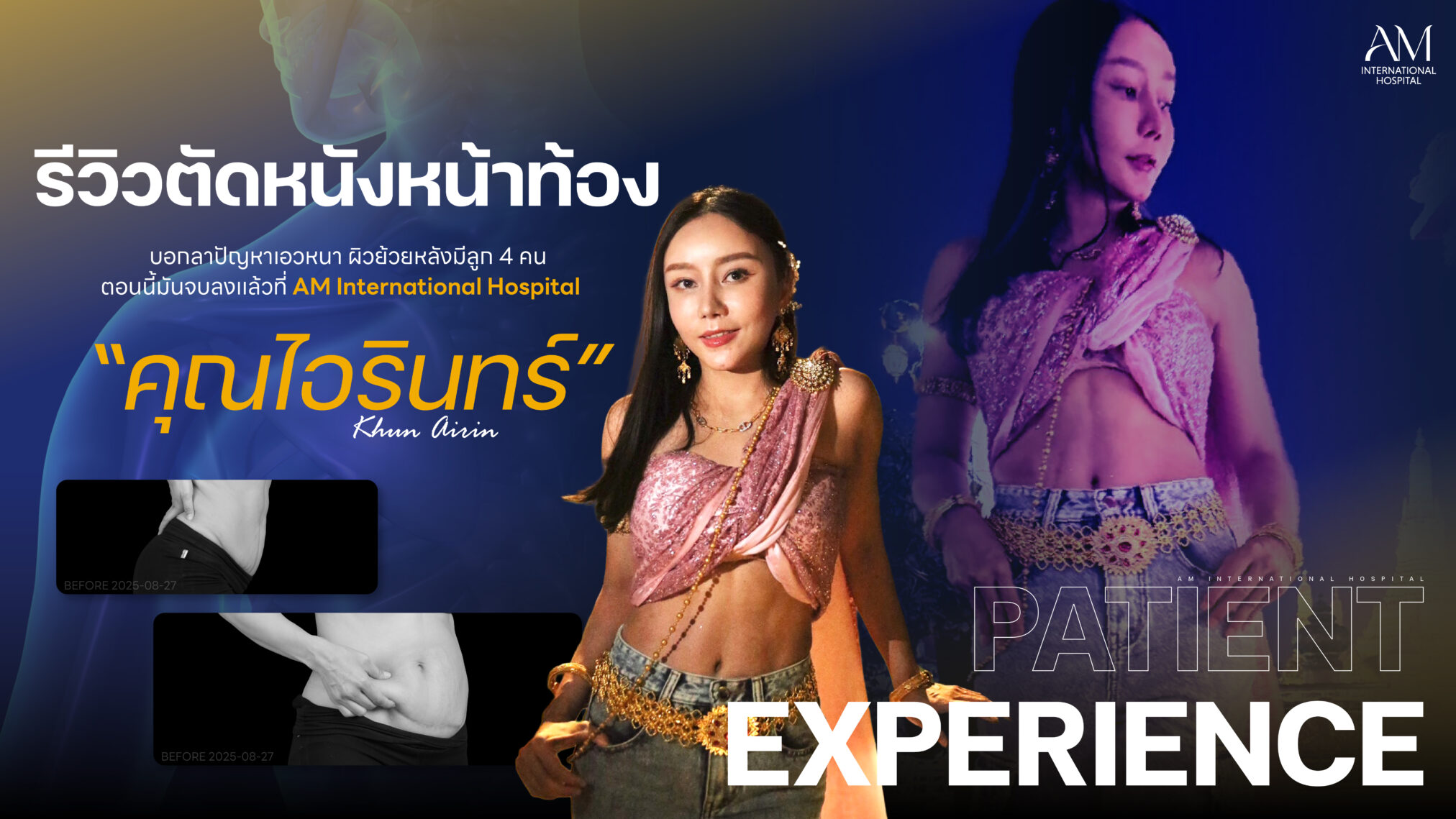 รีวิวตัดหนังหน้าท้อง