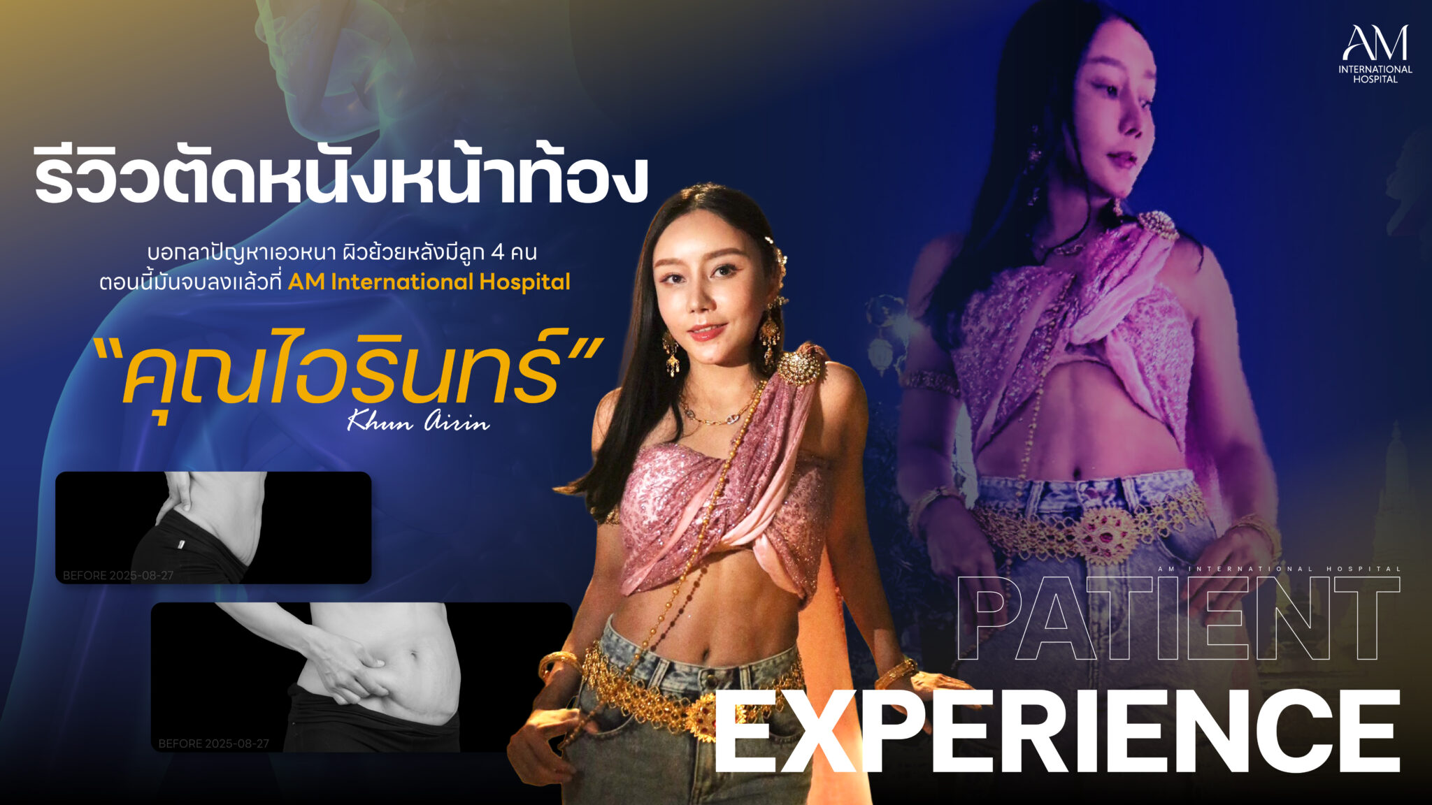 รีวิวตัดหนังหน้าท้อง