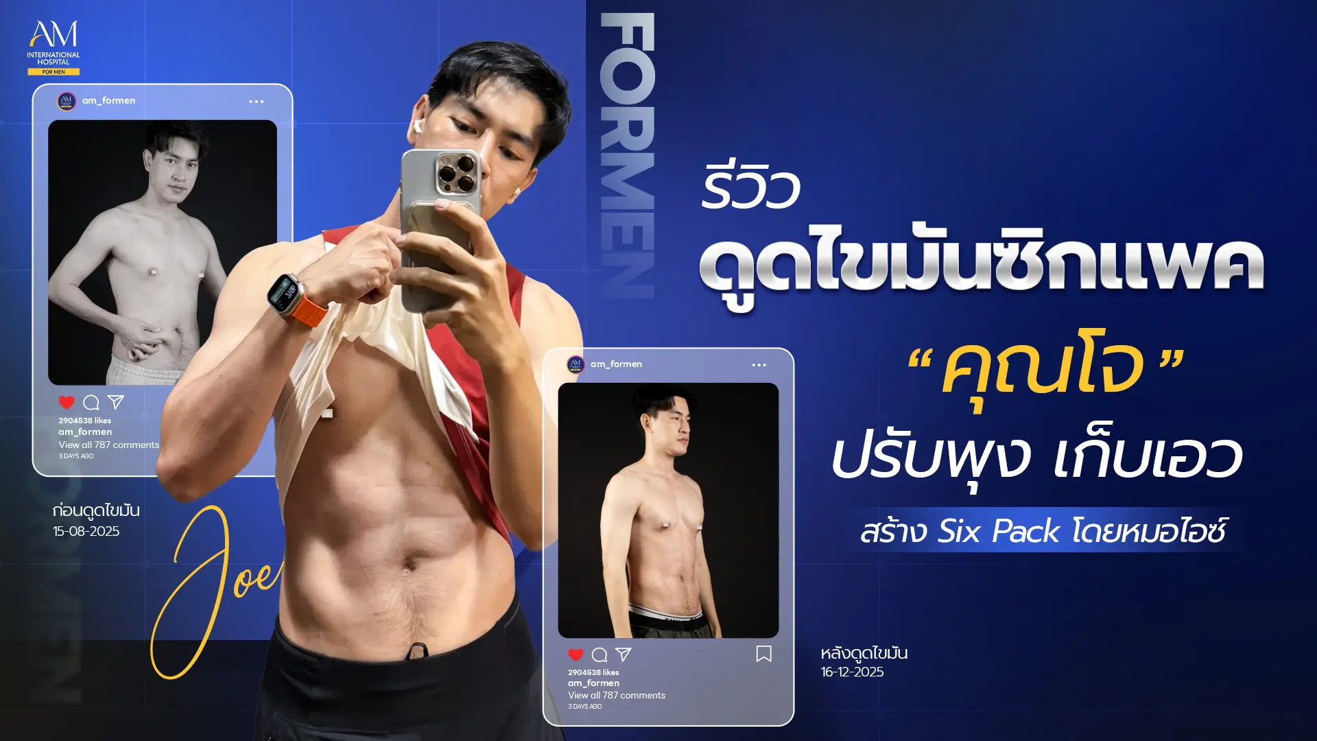 รีวิวดูดไขมัน Six Pack