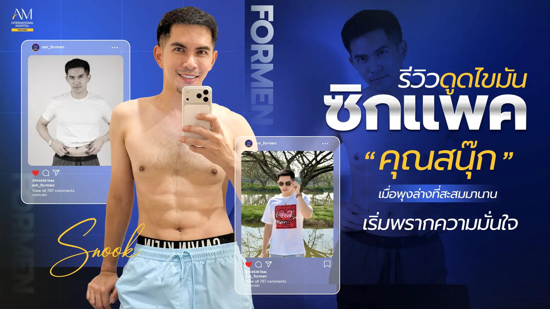 รีวิวดูดไขมัน