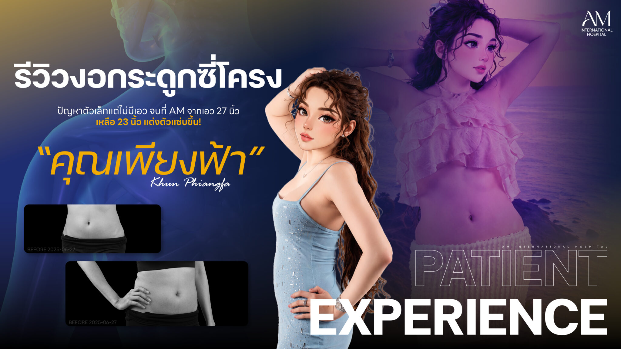 รีวิว งอกระดูกซี่โครง