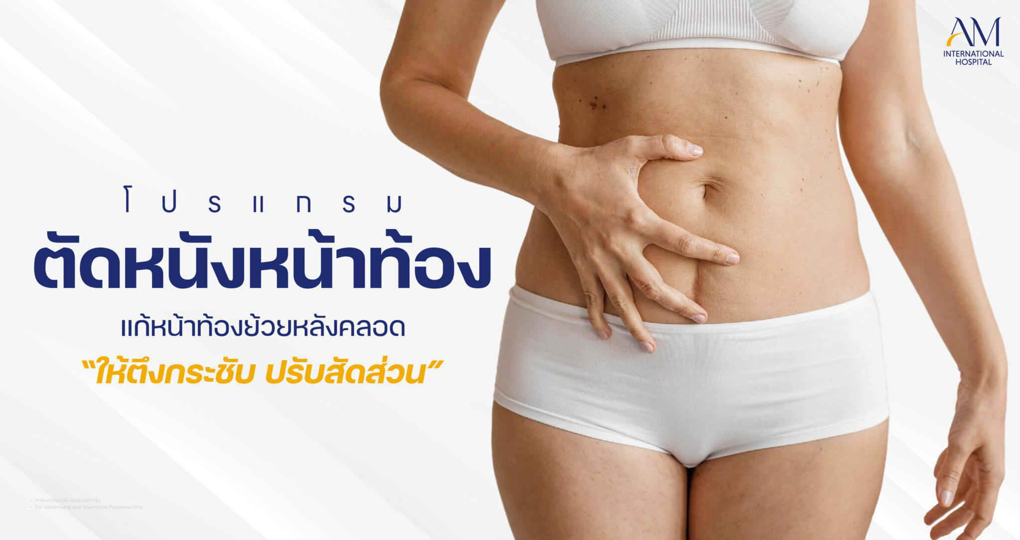 ตัดหนังหน้าท้อง