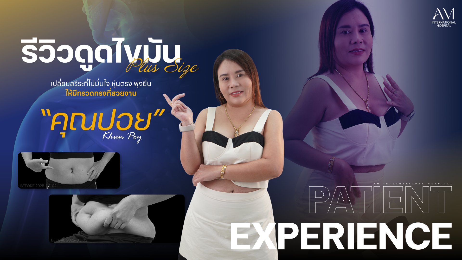 รีวิวดูดไขมัน