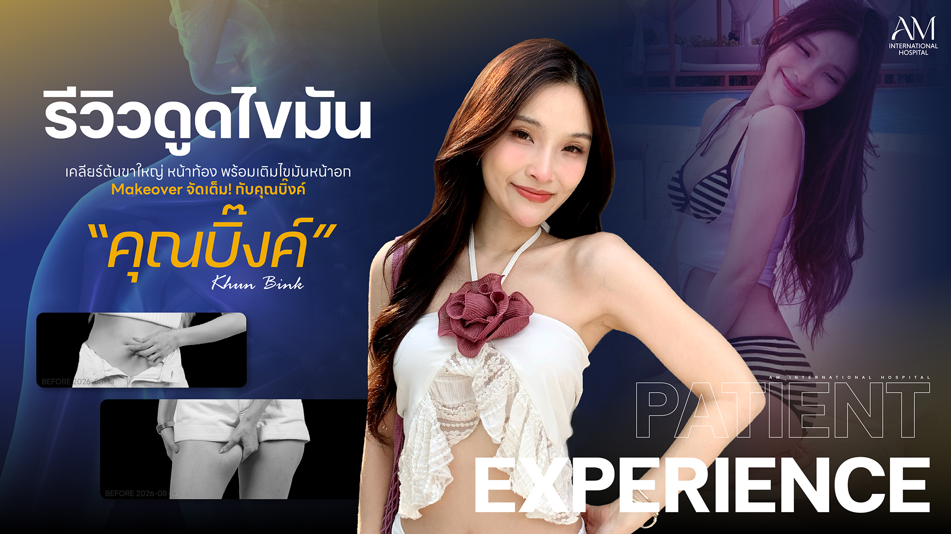 รีวิวดูดไขมัน