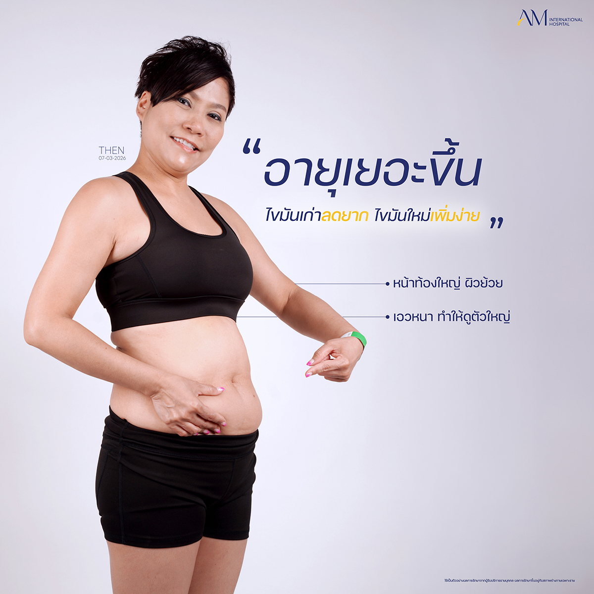 ปัญหาหน้าท้องใหญ่ รีวิวดูดไขมัน คุณแจนเจอร์