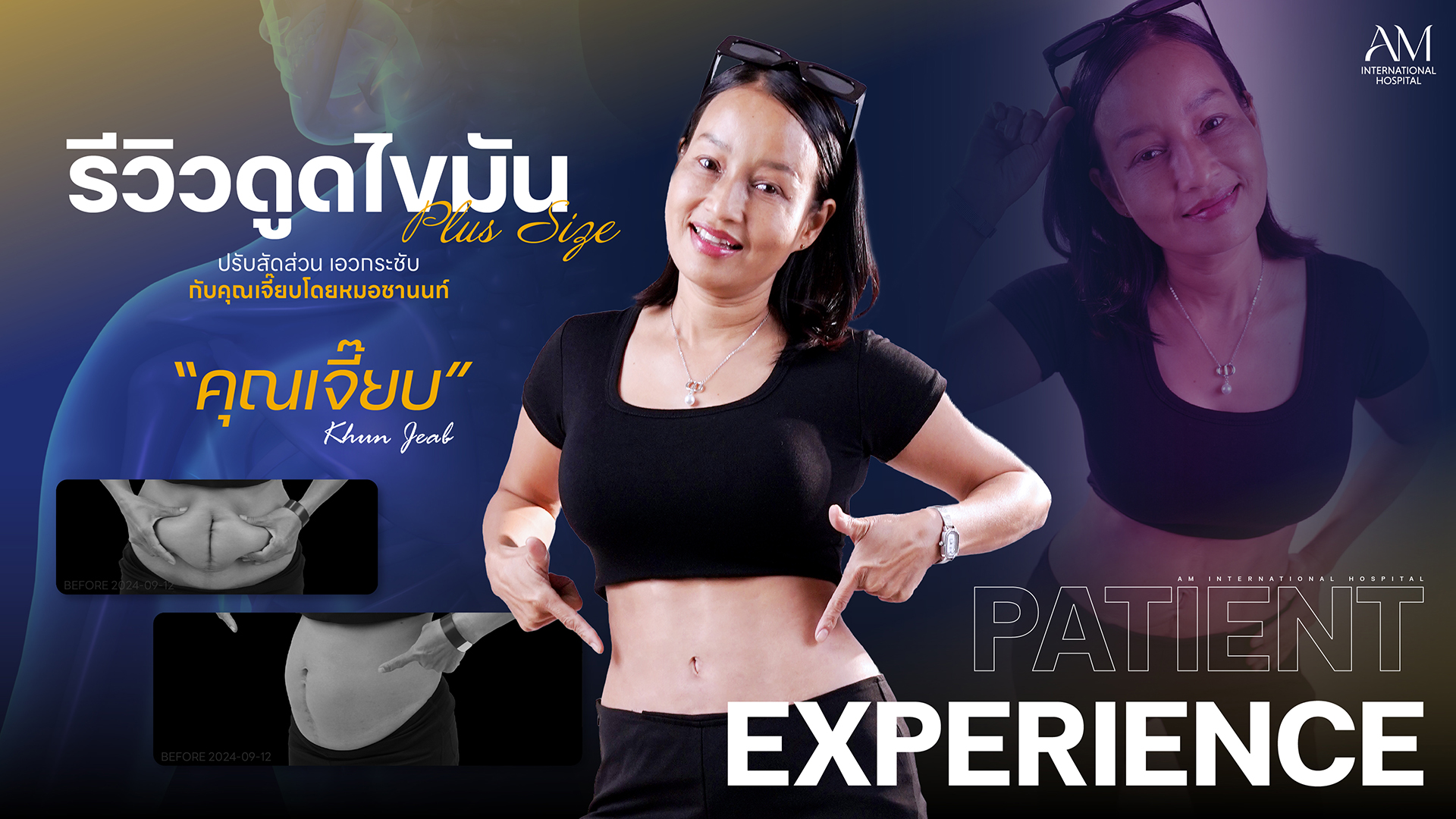 รีวิวดูดไขมัน