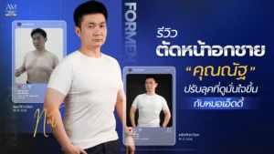รีวิวตัดหน้าอกชาย