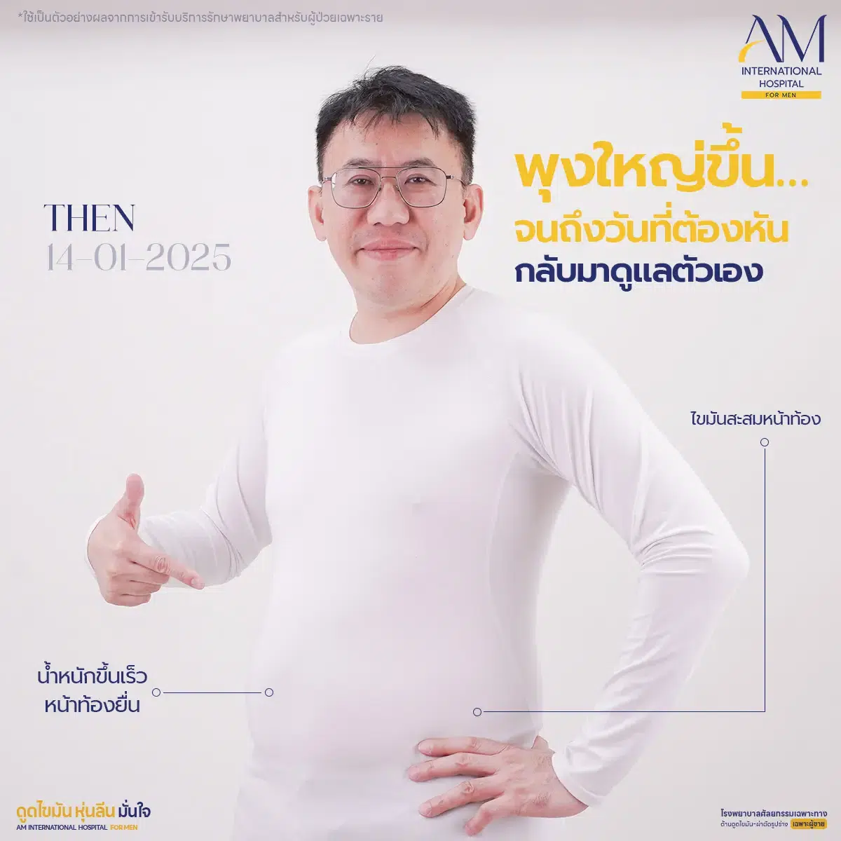 ไขมันสะสม