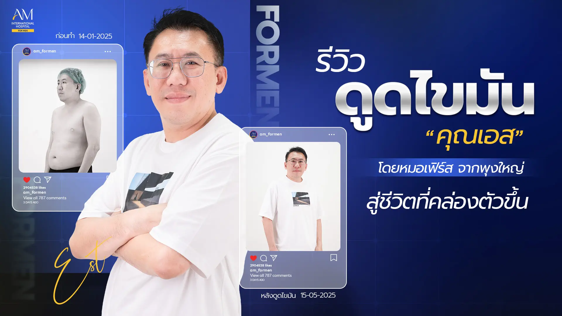 รีวิวดูดไขมัน