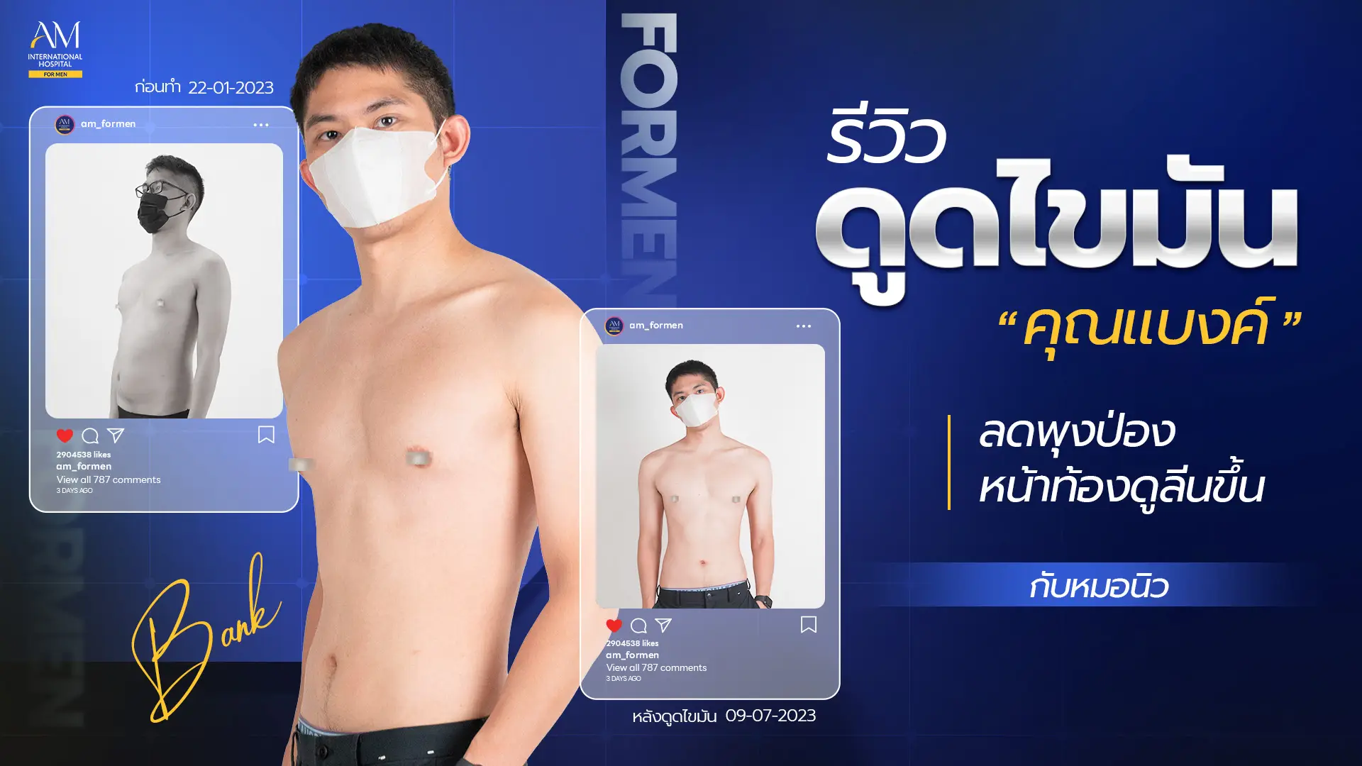 รีวิวดูดไขมัน