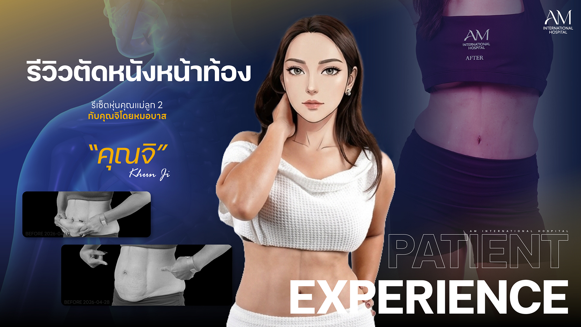 รีวิวตัดหนังหน้าท้อง