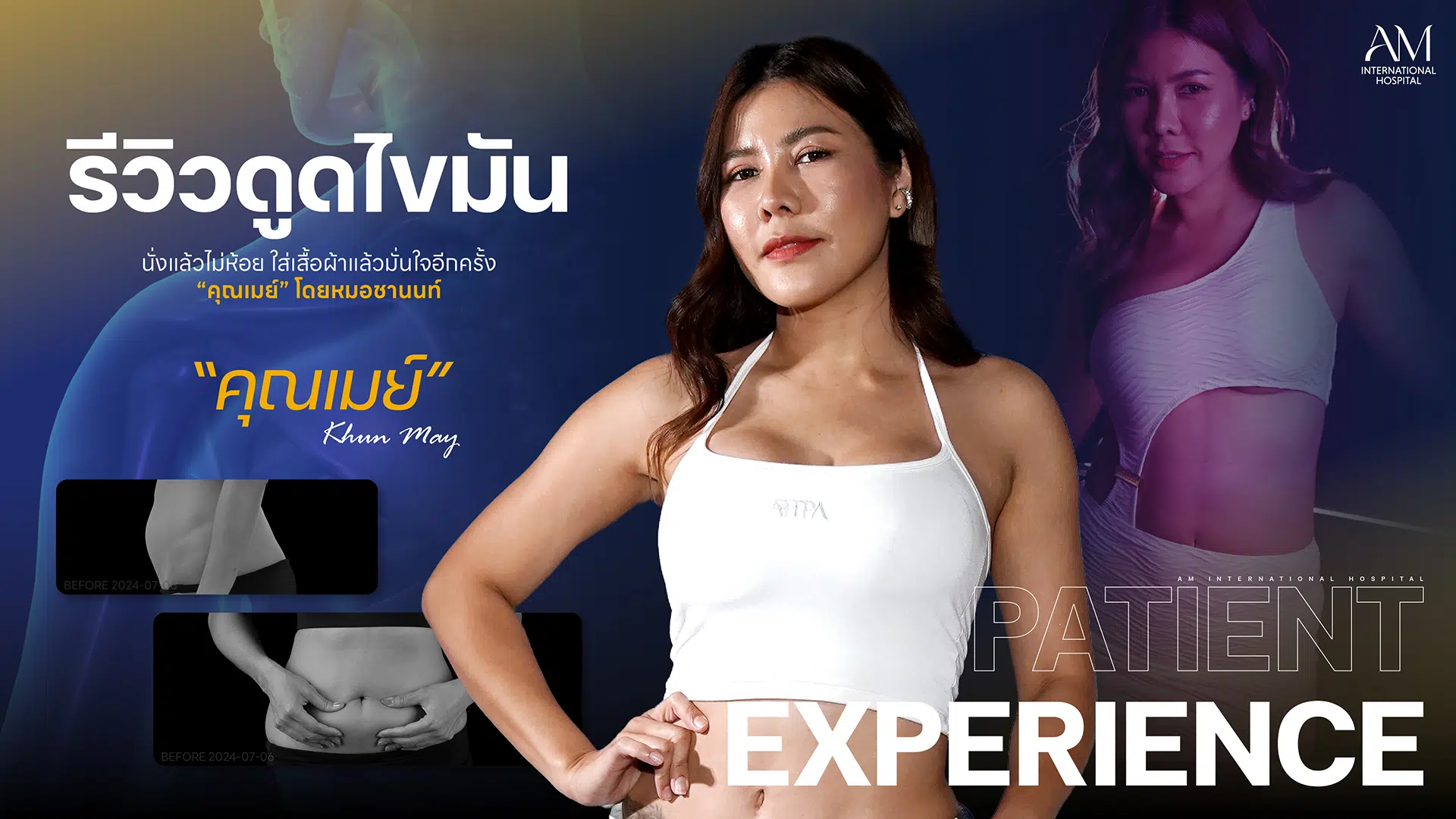 รีวิวดูดไขมัน