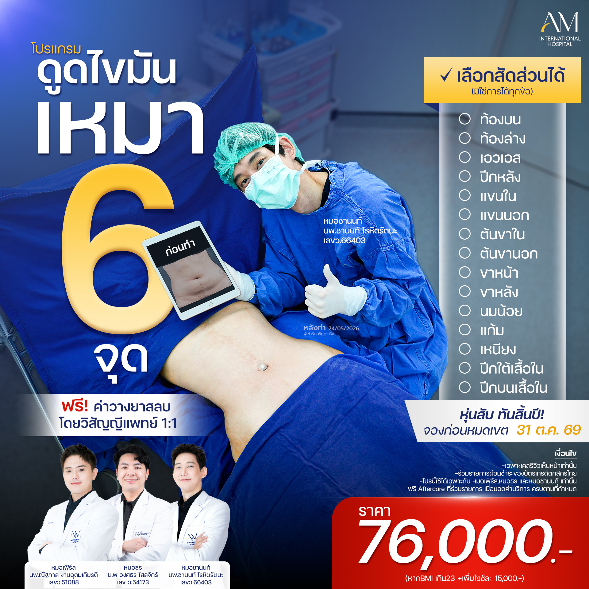 20260921-Conver-Single-โปรเหมา6จุดOct
