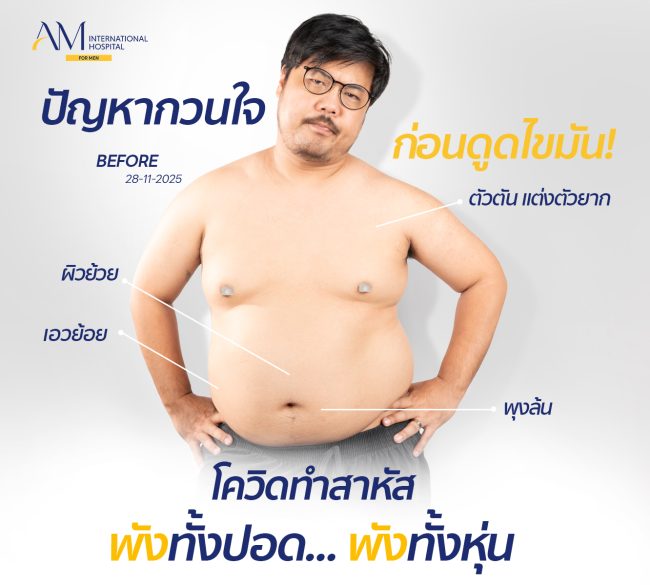 20260113-Consi-Review-Album- “พุงใหญ่” ใส่รองเท้า ยังลำบาก! 13357 13322