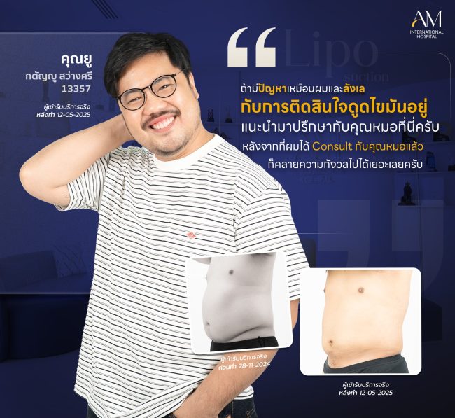 Lipo Suction คุณ ยู ปิดหัวนม