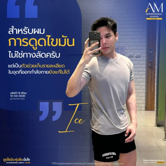 รีวิวหลังดูดไขมัน