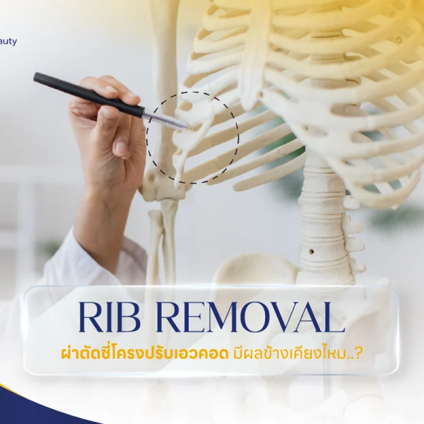 Rib Removal