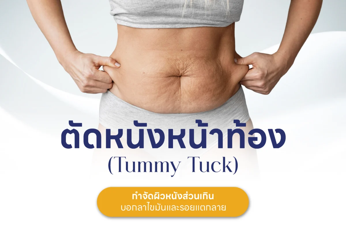 ตัดหนังหน้าท้อง-02